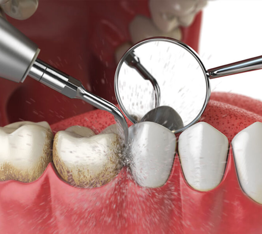 best-dentist-near-me