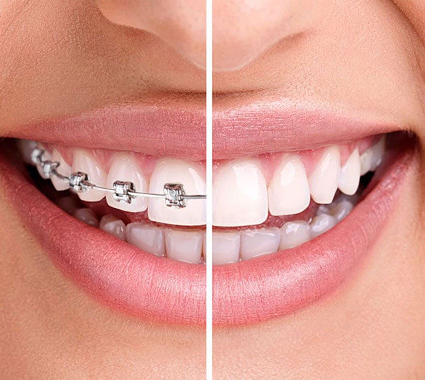 dental-clinic-in-valasaravakkam