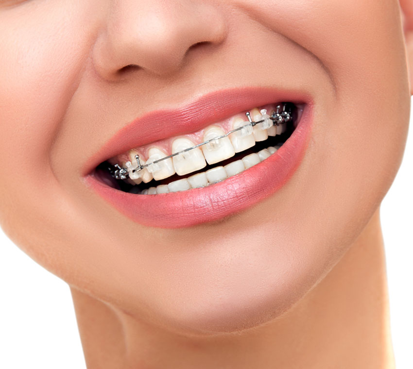 dentist-in-valasaravakkam