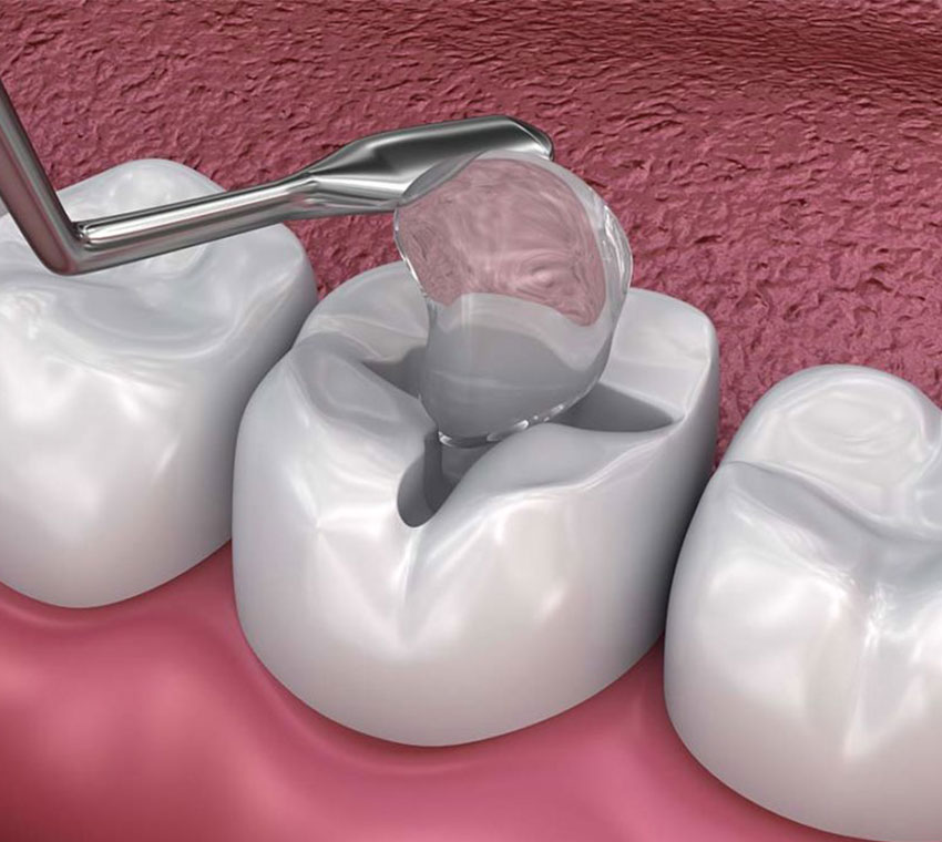 best-dentist-near-me