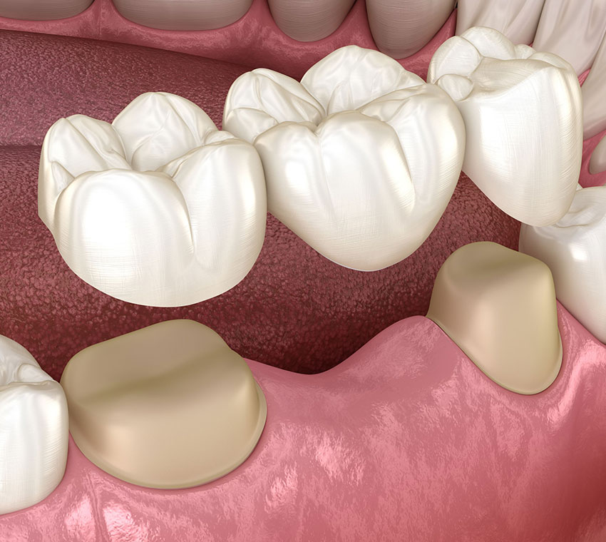 best-dental-clinic-in-valasaravakkam