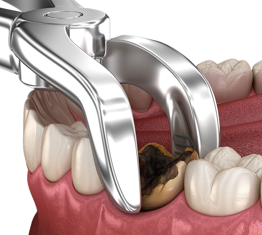 dental-clinic-in-valasaravakkam